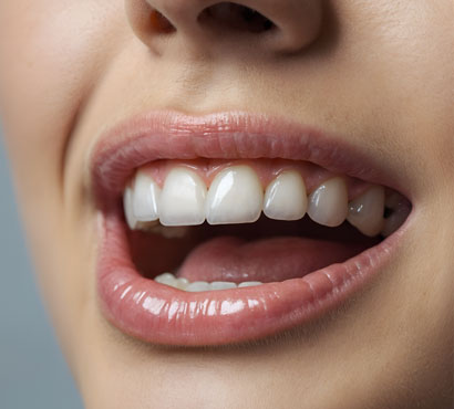 Enhance your smile’s beauty with customized cosmetic dental treatments and solutions.